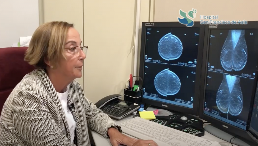 El hospital San Francisco de Asís realiza biopsias de mama guiadas por ecografía.